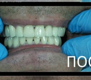 Стоматологическая клиника Альфа Стом